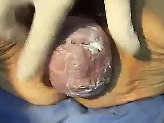 Omas Muschi
