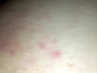 fresh pain in the neck