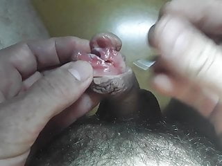Keen and subincision
