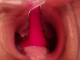 Silver-tongued Pussy - Burnish apply Median Surface